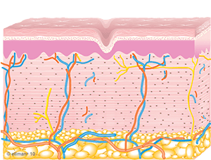 Collagen Remodeling Occurs | Skin Tightening